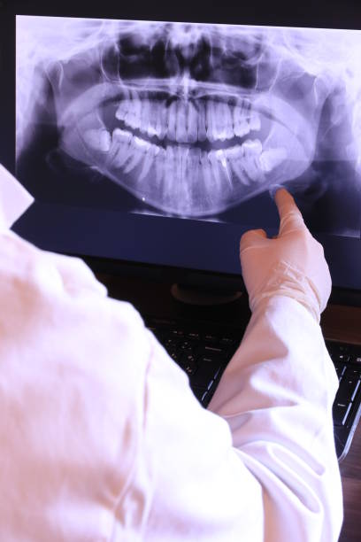 Best Emergency Wisdom Teeth Removal in White City, UT